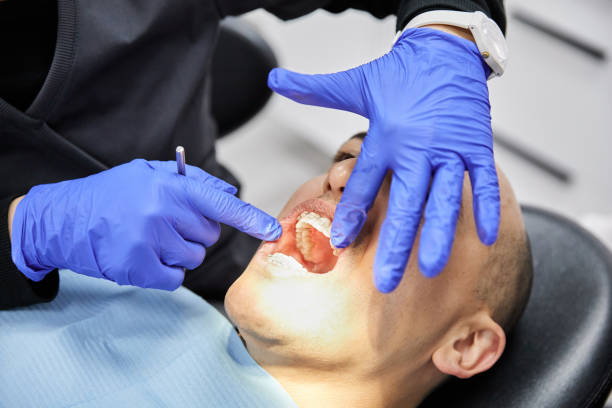 Best Emergency Broken Tooth Repair in Palmetto Bay, FL